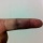 My Swollen Finger